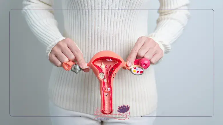 حقن البلازما في المبيض Plasma injection into the ovary