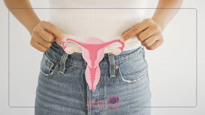 علاج تكيس المبايض