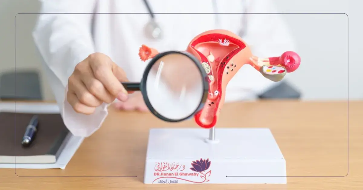 علاج الأورام الليفية بدون جراحة