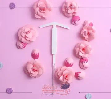 أنواع اللولب لمنع الحمل