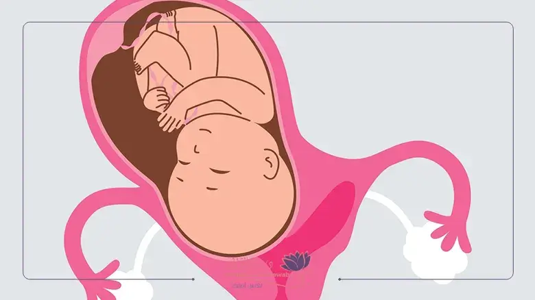 الحمل مع وجود الحاجز الرحمي