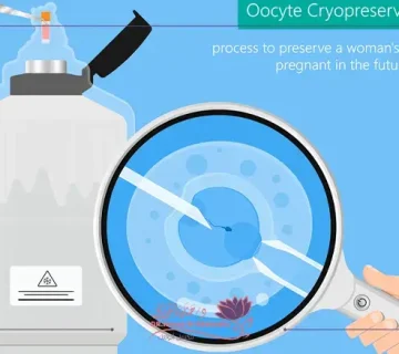 الاستعداد لنقل الأجنة المجمدة