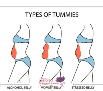 التجميل النسائي بعد الولادة