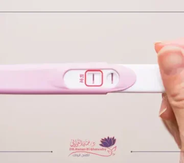 العلاقة بين الوزن وتأخر الإنجاب