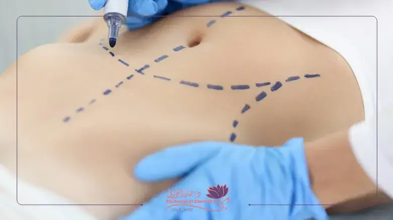تصحيح عيوب عمليات التجميل النسائي السابقة