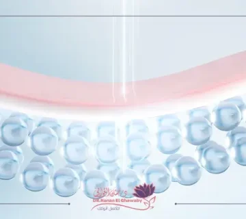 تفتيح المناطق الحساسة بالليزر